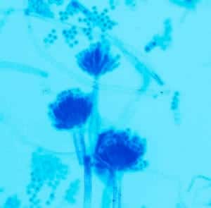 LACTOPHENOL (COTTON BLUE) For Microscopy