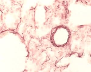 ORCEIN For Microscopy Natural Red 28 Histological staining reagent stains elastic tissue in fixed tissue differentiates chromosomes from other structures for elementary animal tissue structure. Leucokyle stain.