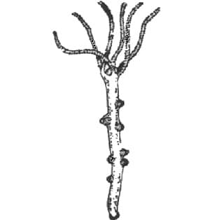 Hydra Gastrula with Embryonic Theca W.M.
