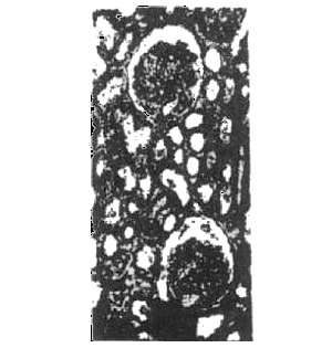 Kidney