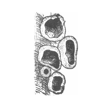 Peziza clusters